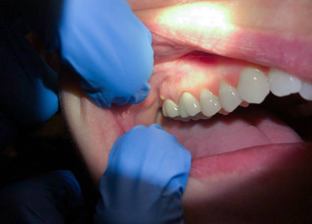 Best Weekend Emergency Dentist in Culloden, WV