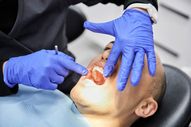 Best Emergency Treatment for Toothache in Culloden, WV